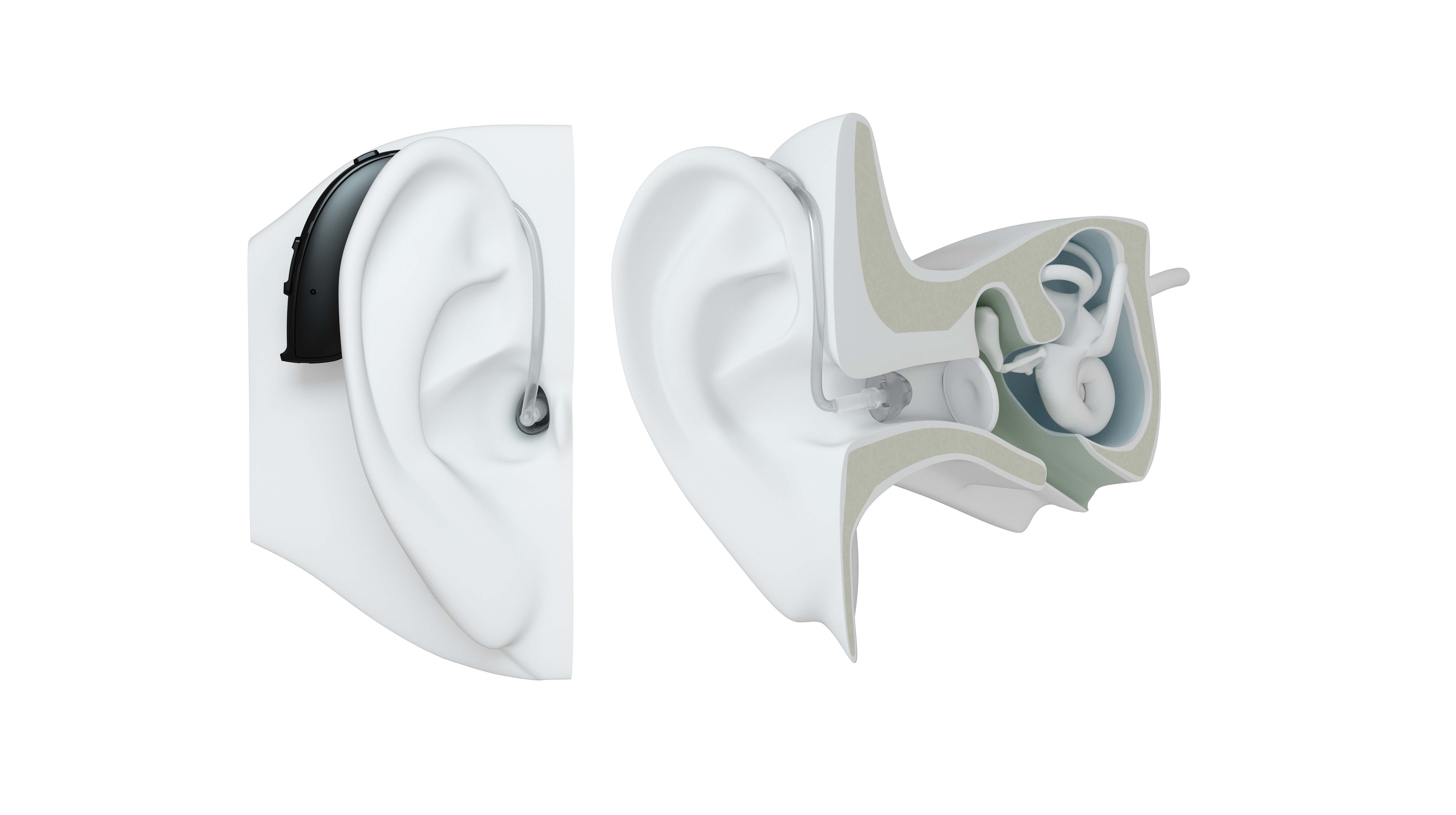 BTE hearing aid style on ear.