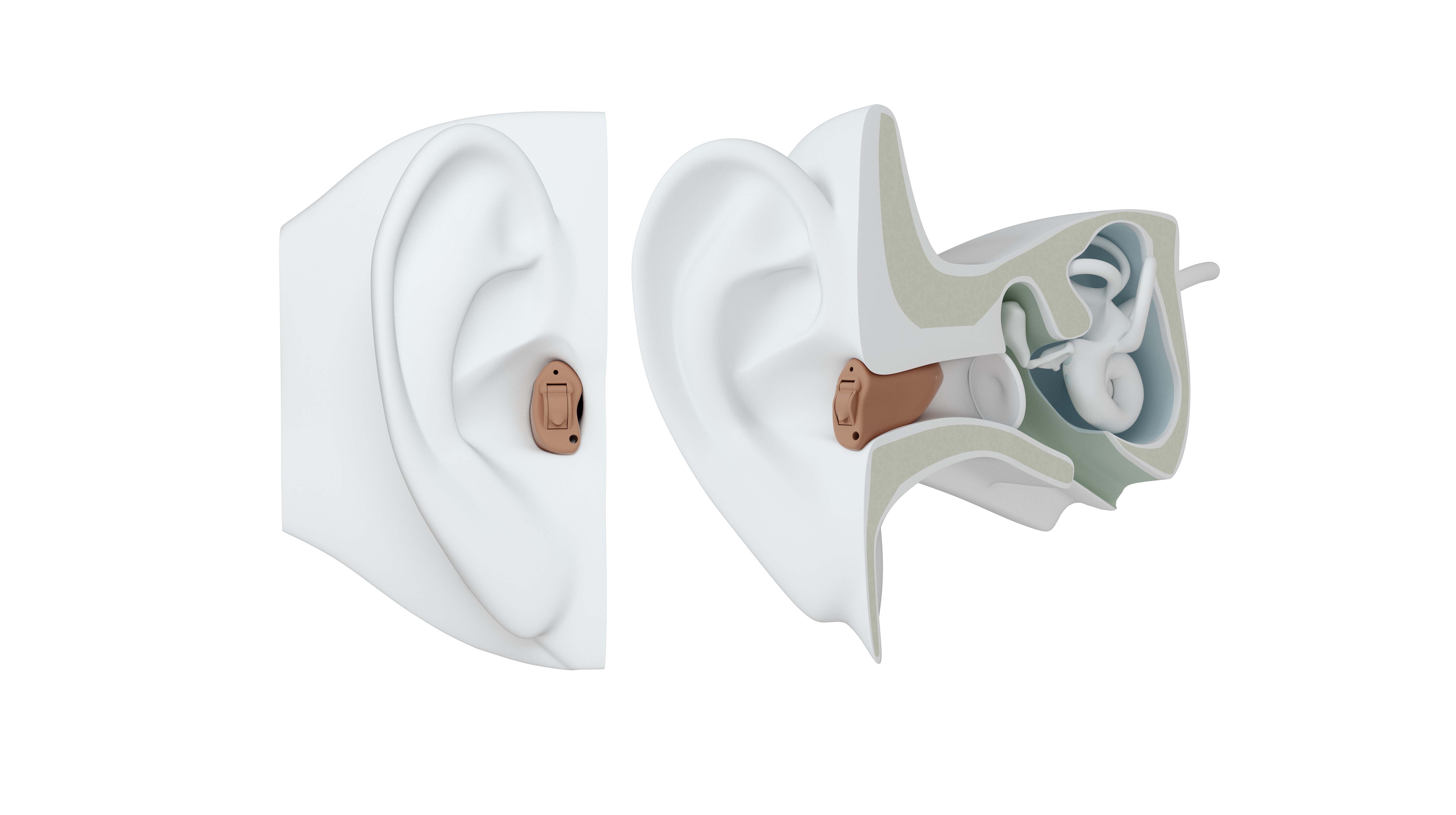 CIC hearing aid on ear.