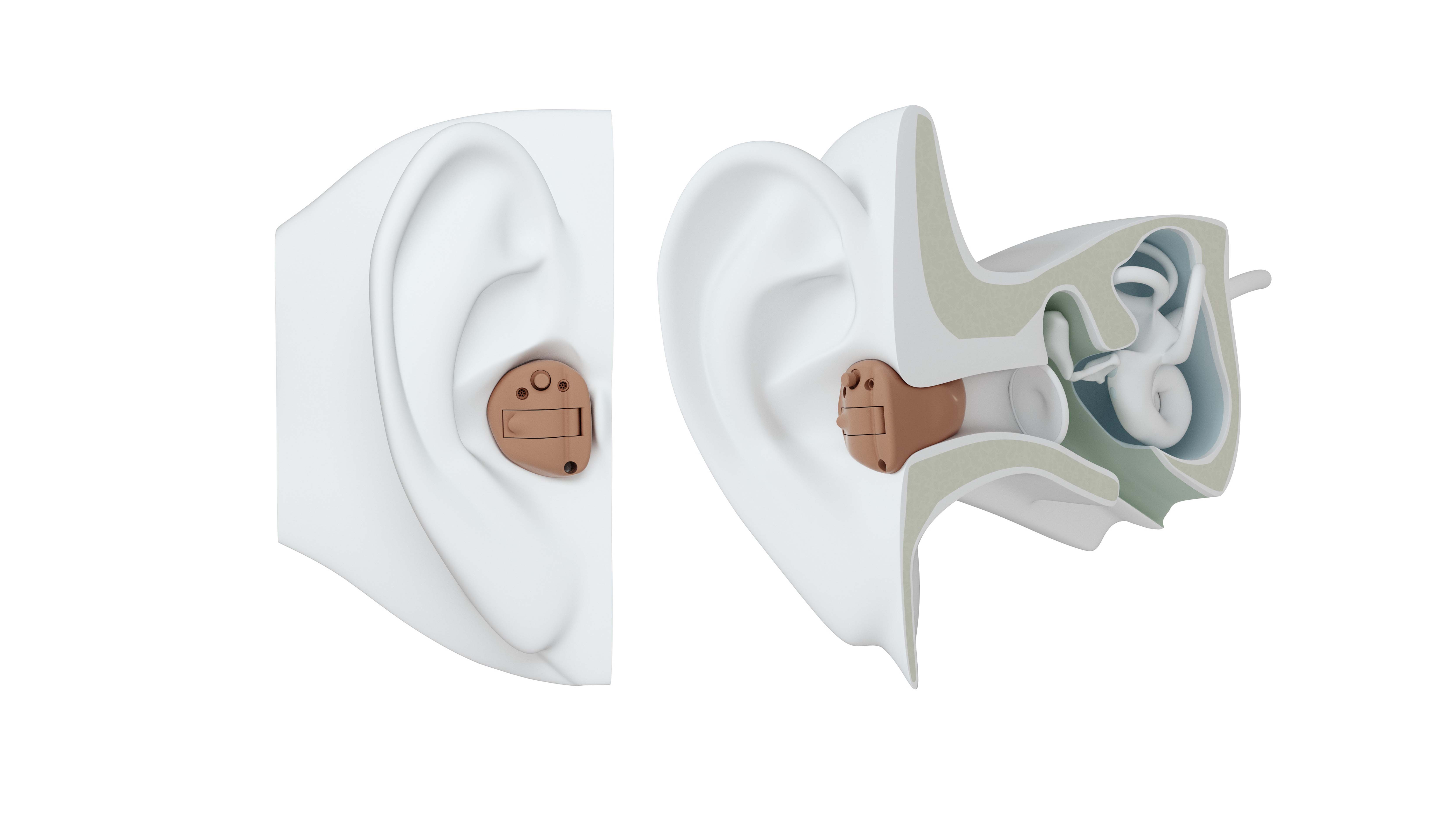 ITC hearing aid on ear.