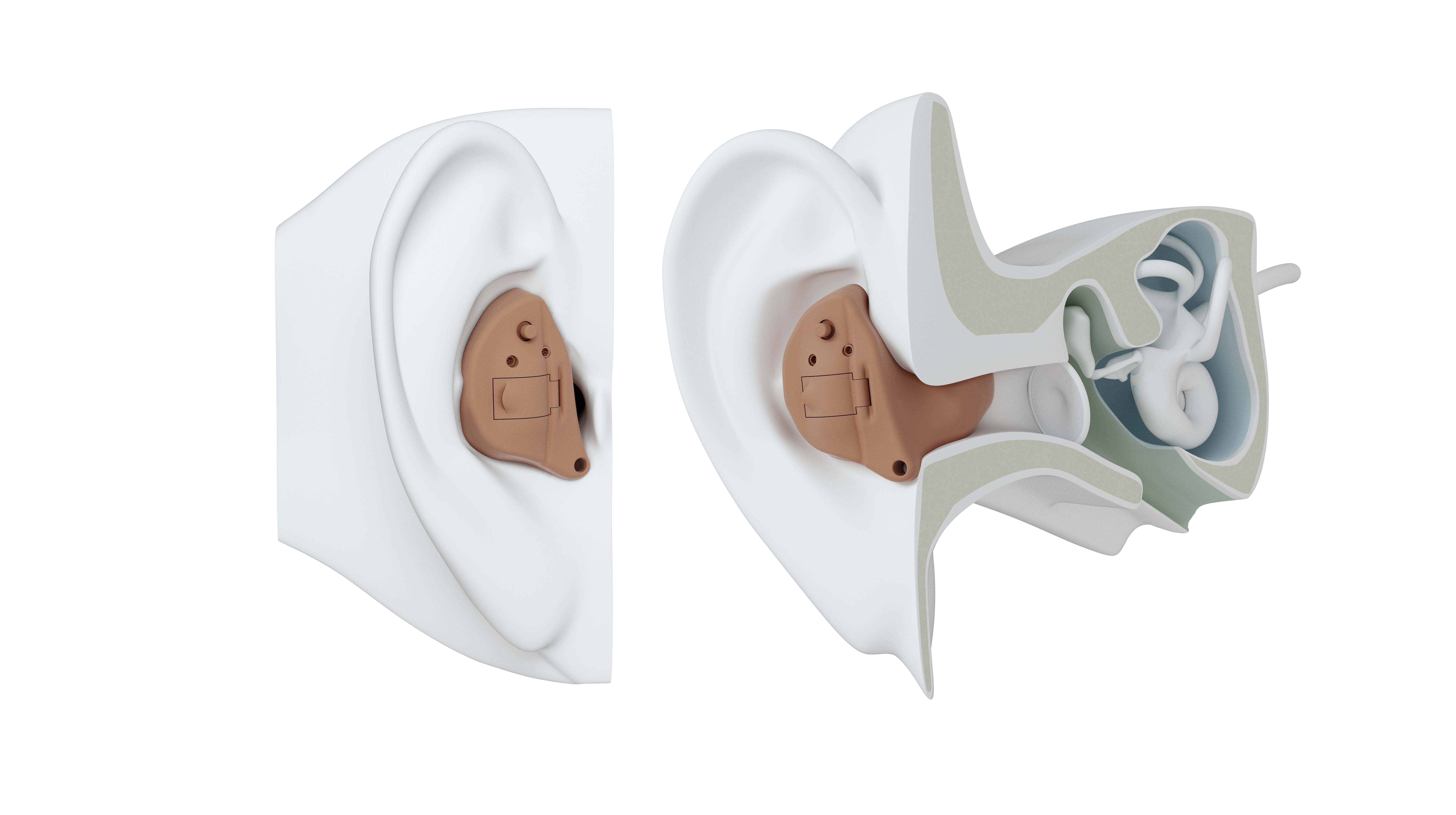 ITE hearing aid on ear.