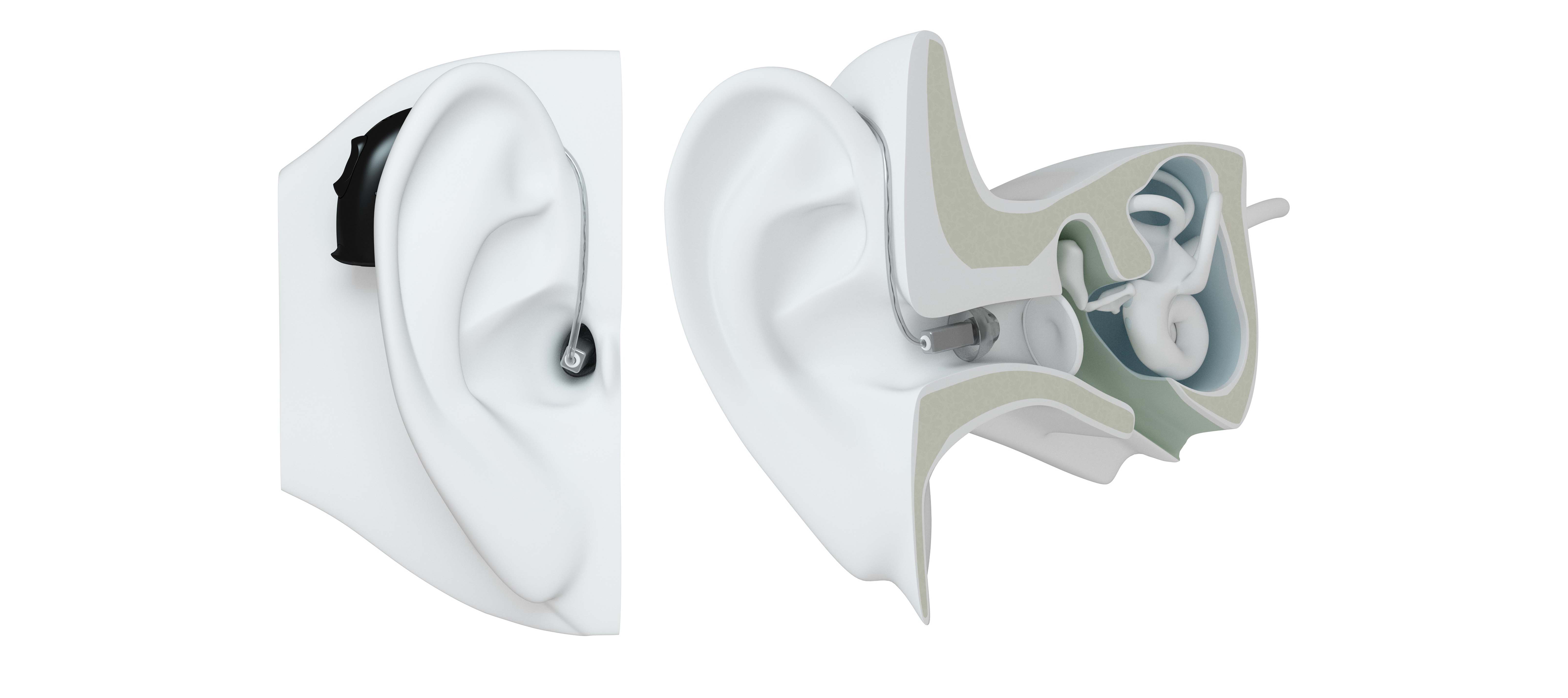Modelli con ricevitore nell'orecchio | Apparecchi acustici Resound